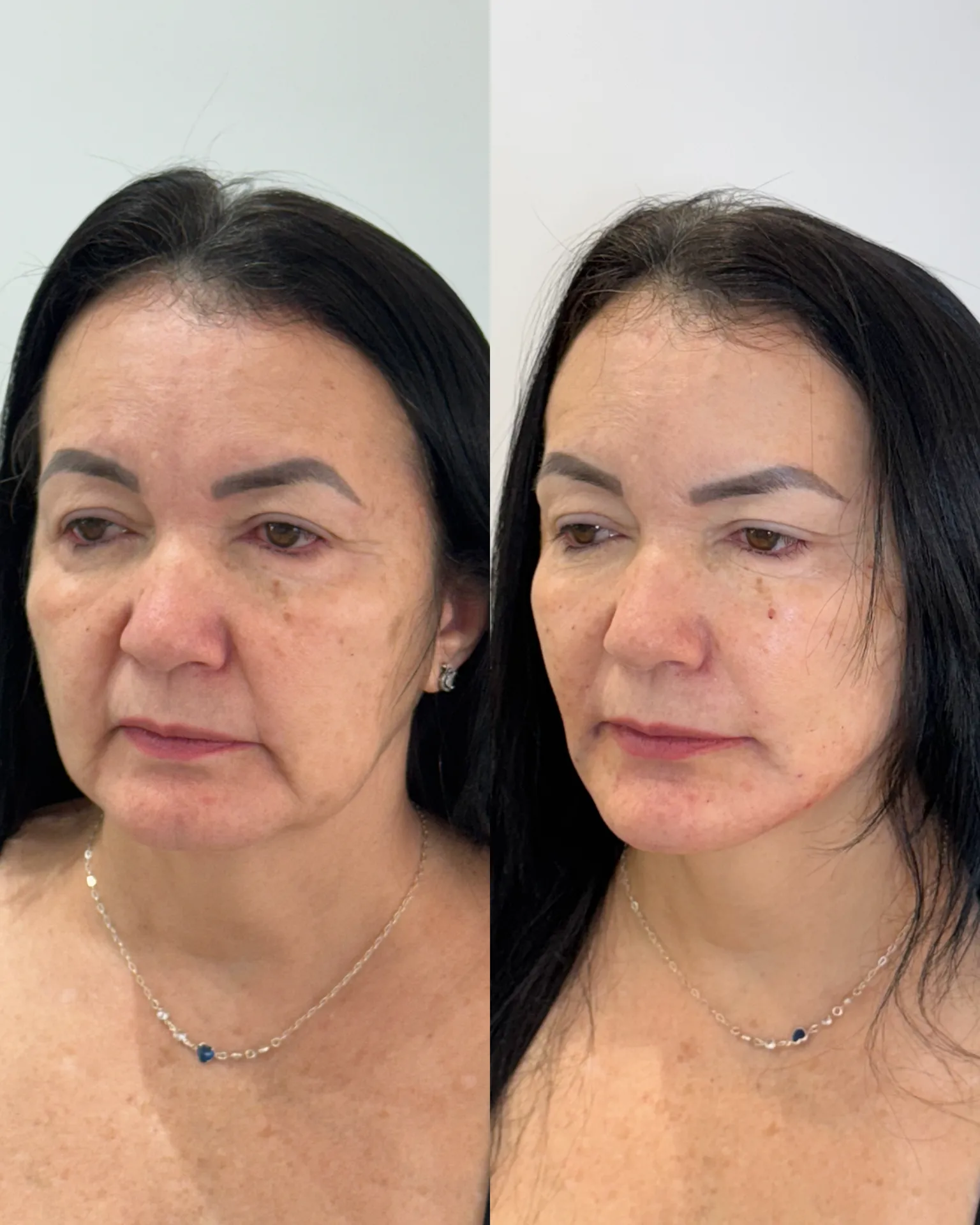 ADA653F8-EC1D-4A8D-91EF-61BB8D36BD5B