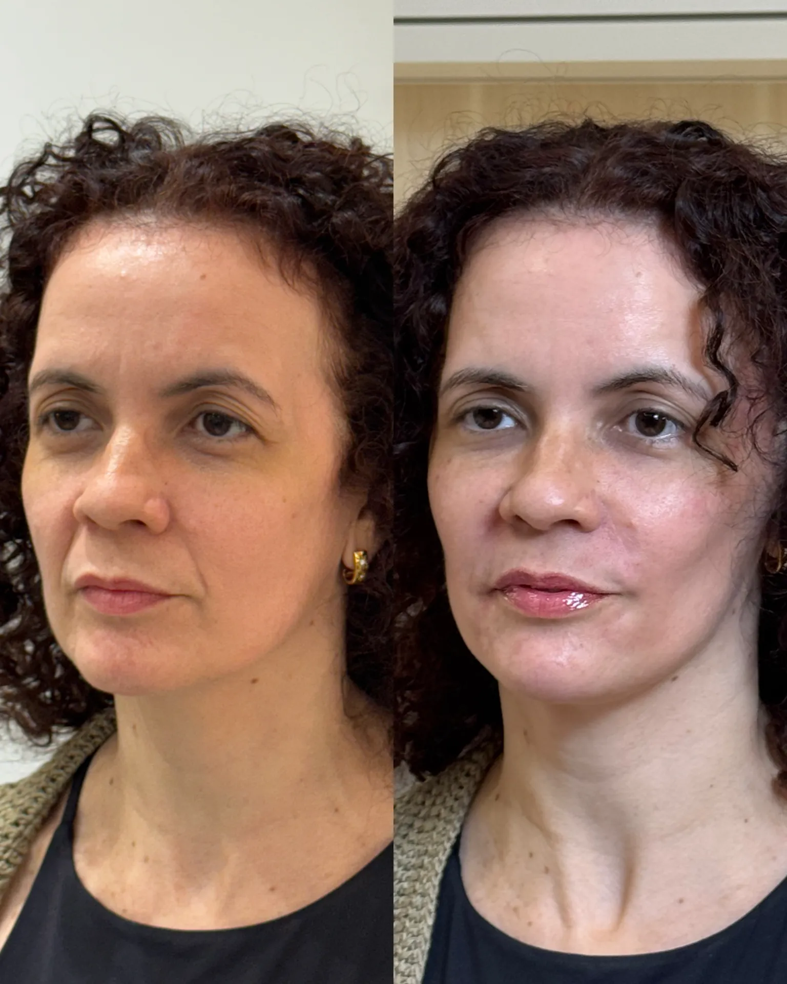 BACAE80B-AFD1-4BD3-8C99-9DFF37414A61