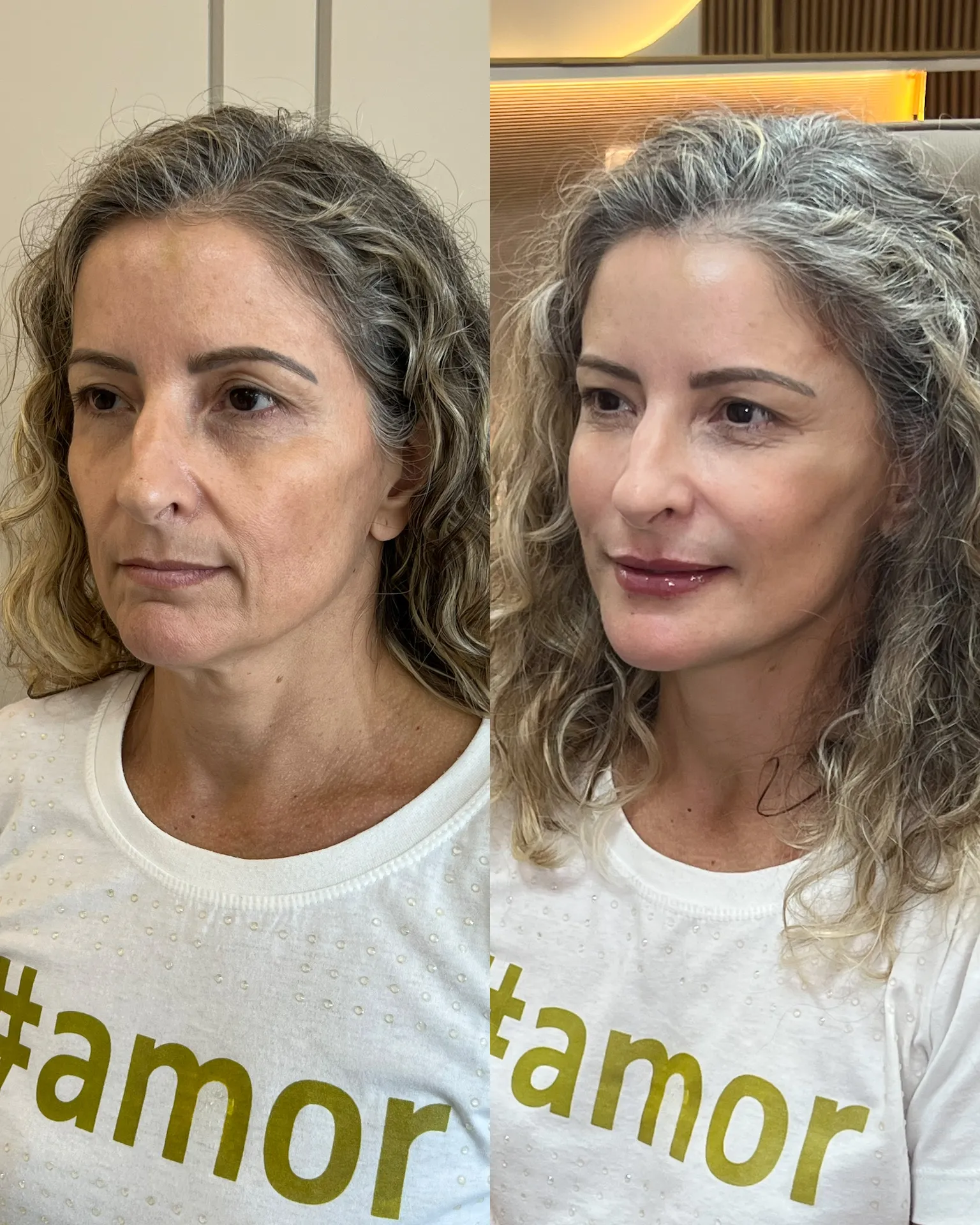 D04C7AE6-A67F-472D-81B1-D1F8366DFCC0