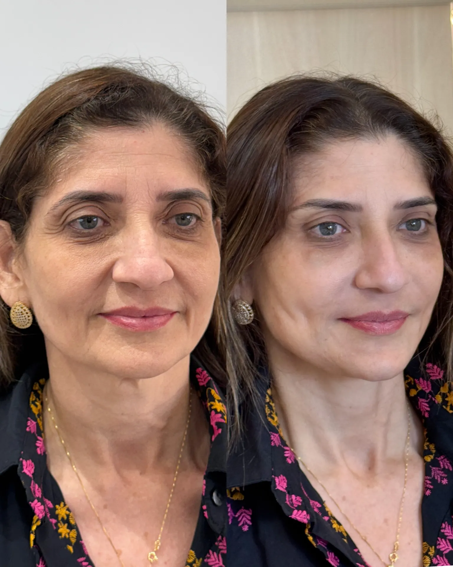 F2E37E2E-1B46-4128-8105-A95FD8F41CE9