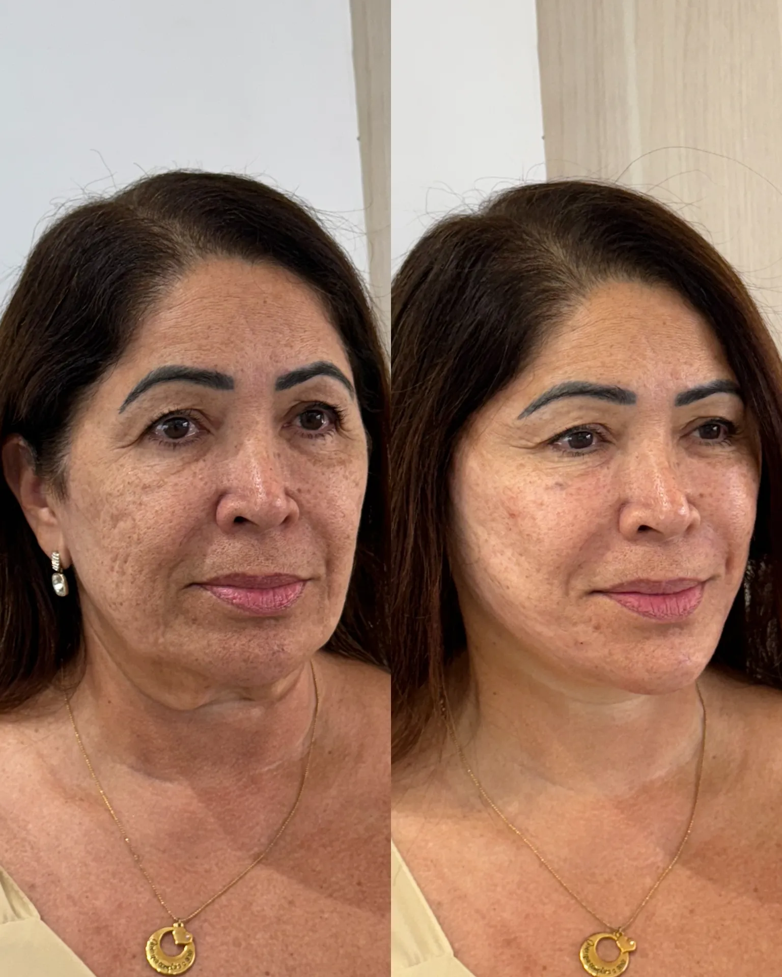 F7043E78-9E4D-43A3-B800-48DE03DE25E4