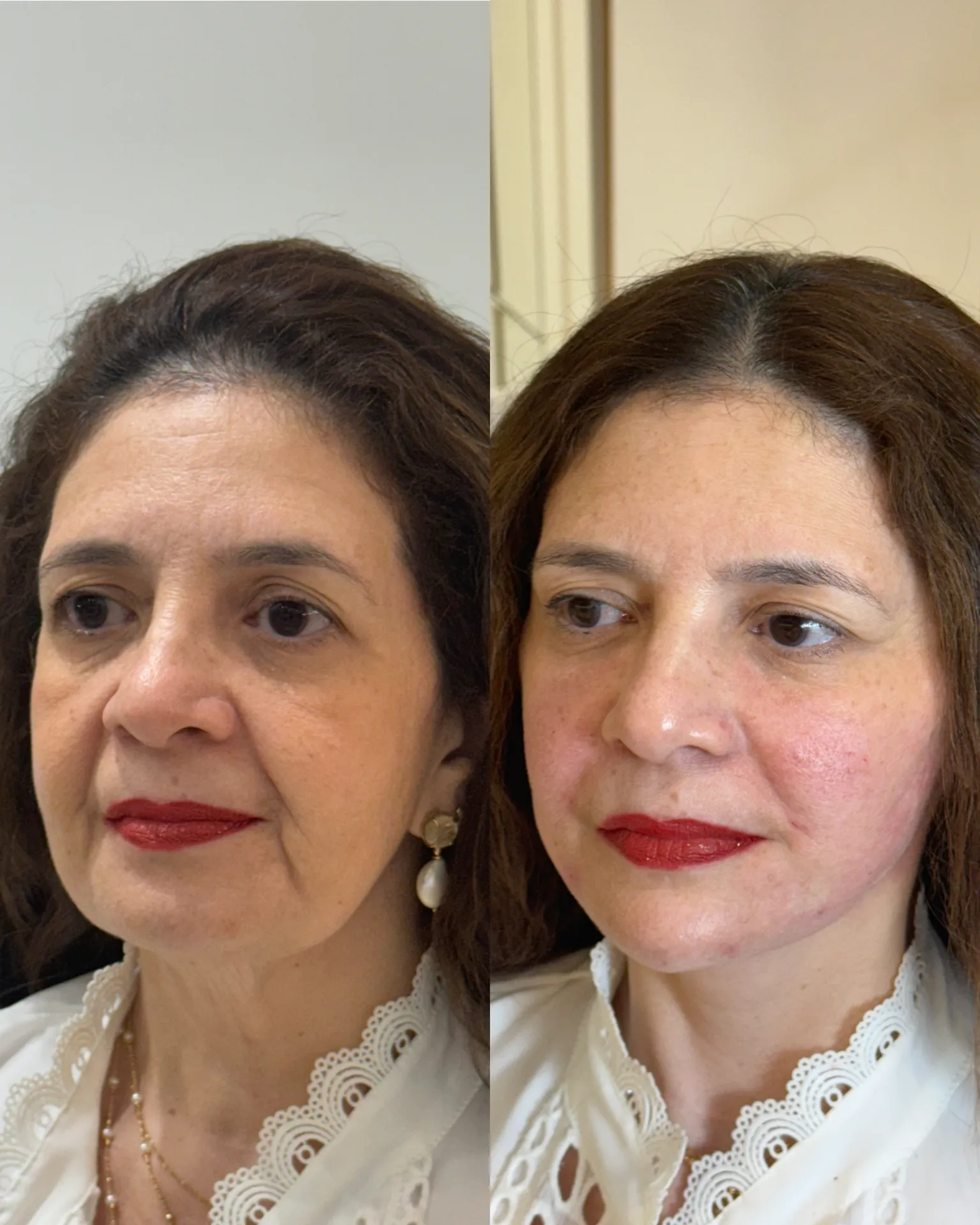 F78B429E-6AE7-40C9-80E8-085DA5A8E1F3