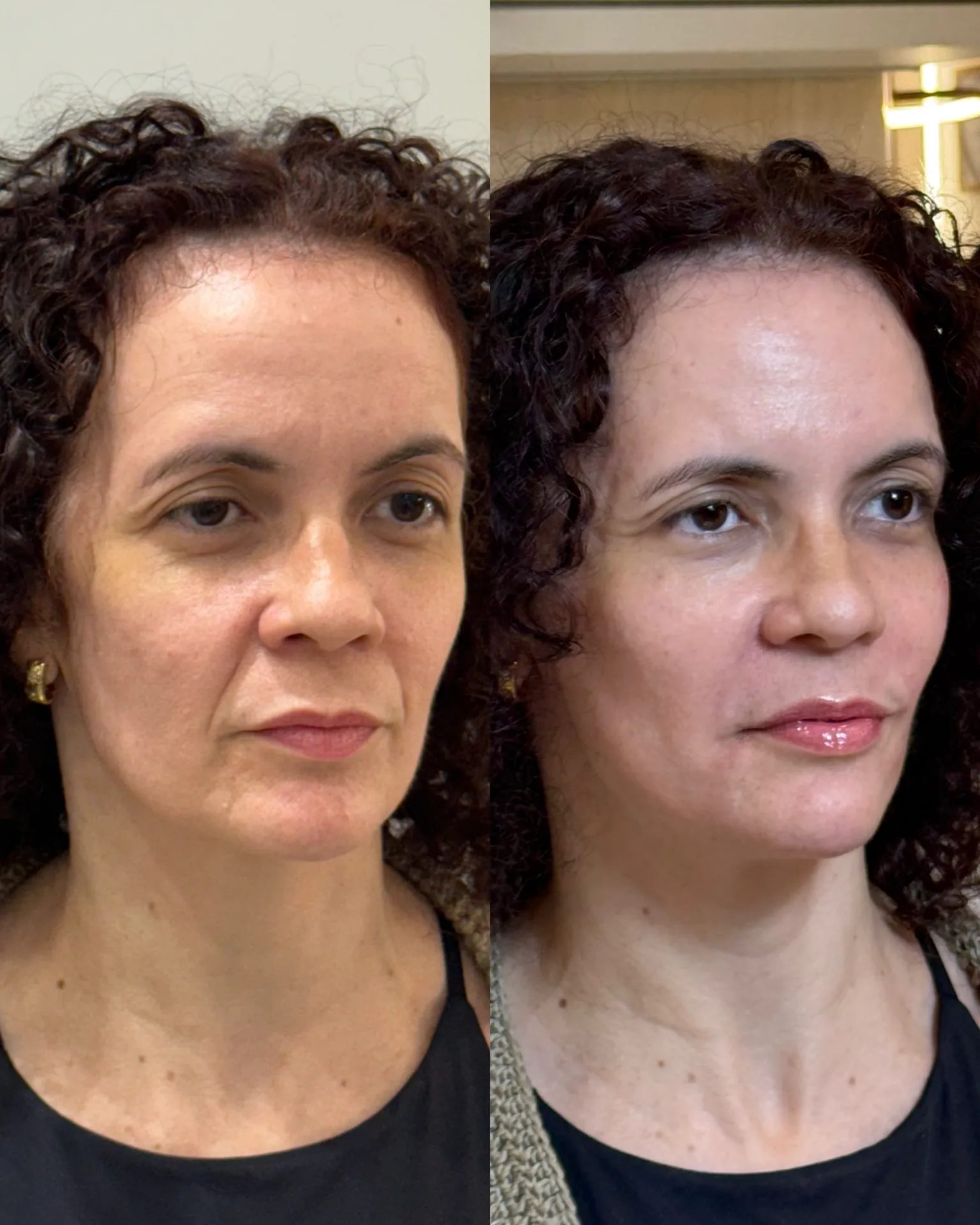 FB8368BA-17DC-4057-8BB8-E868EA8C363E