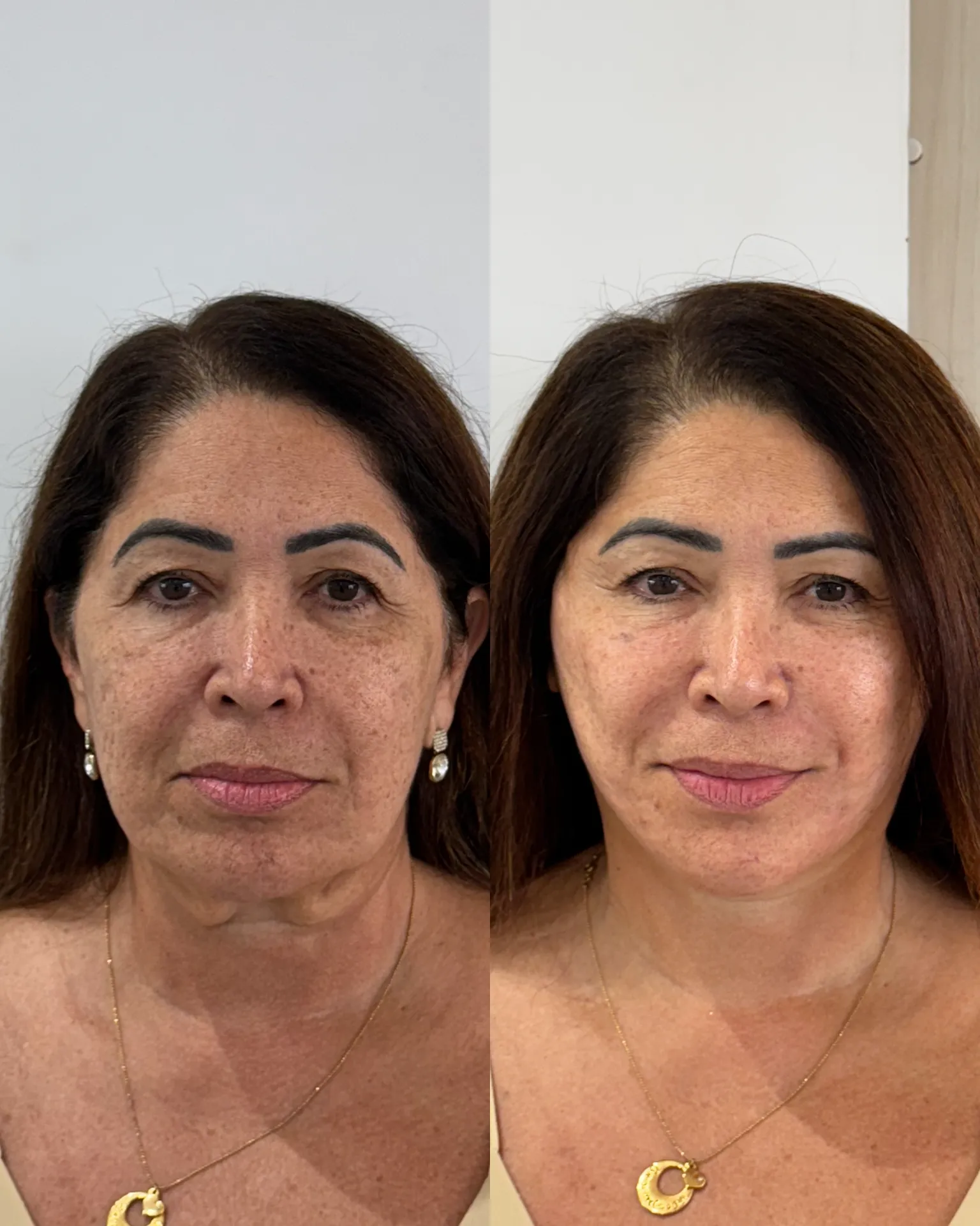 FD2F59B6-D3E9-4A54-8CD9-1D89503237A6